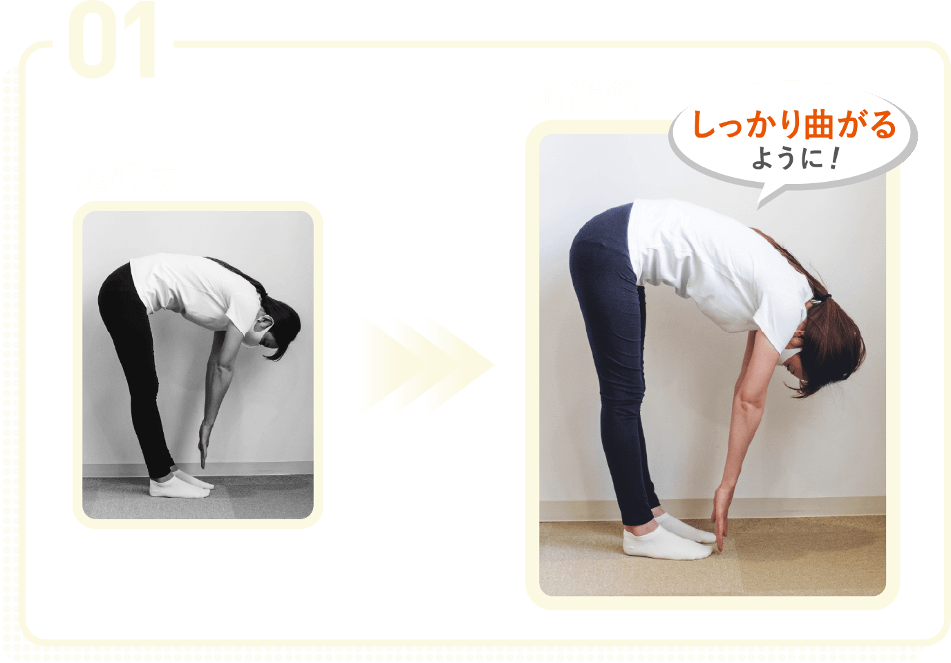 01施術後はしっかり曲がるようになる